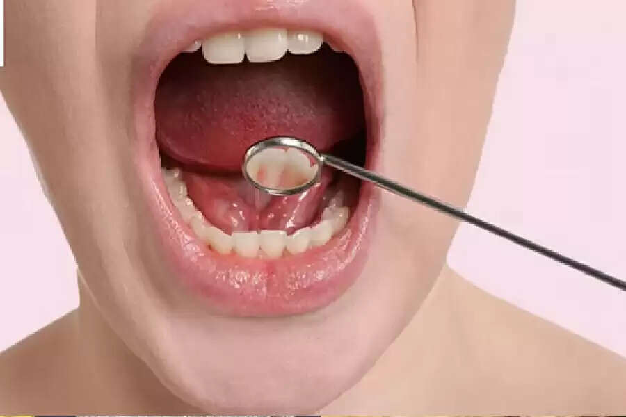 ss