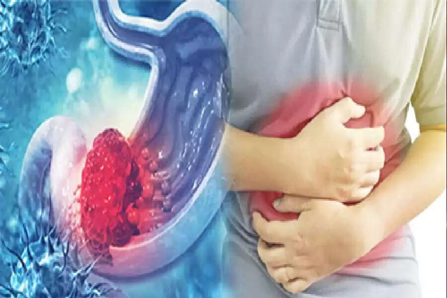 DD