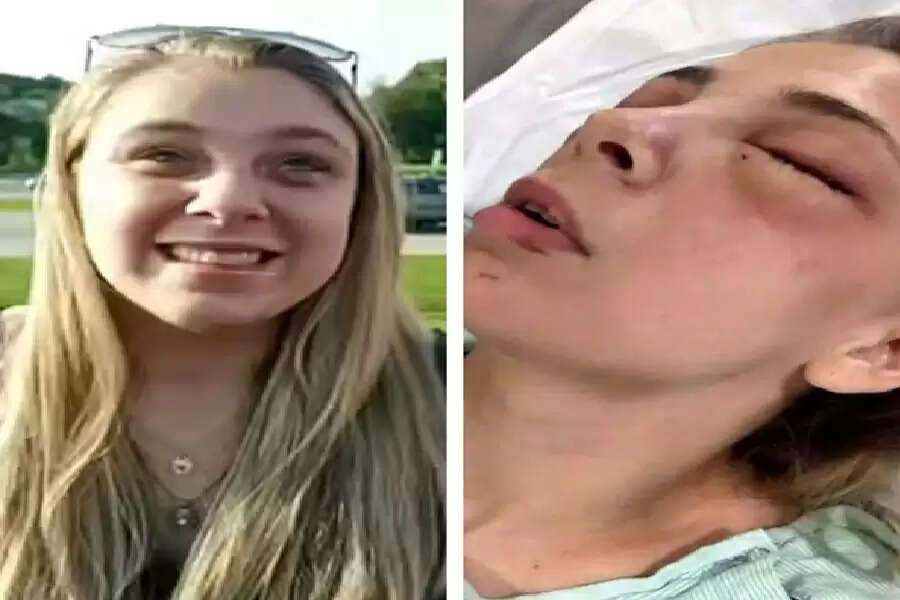 SS