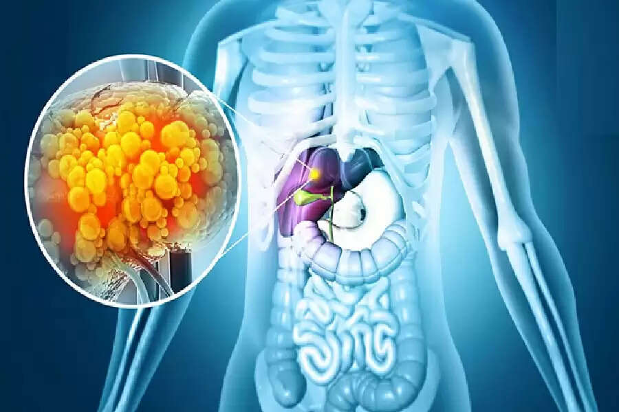 ff