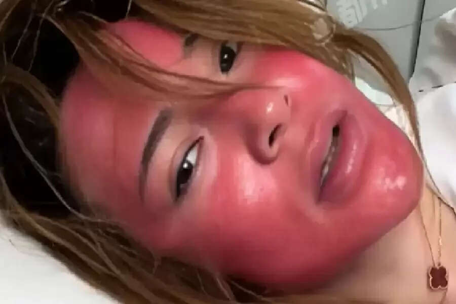 WW