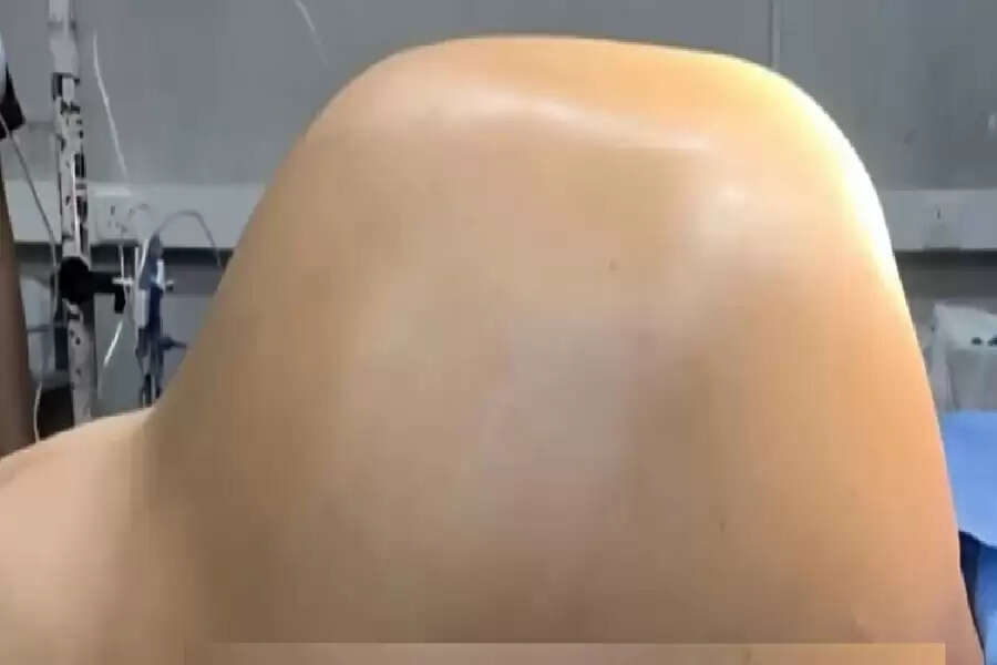 ff