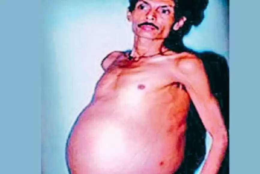 SS