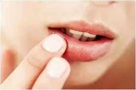 Beauty Tips- क्या आपके होठ फट गए हैं, अपनाए ये नुस्खें