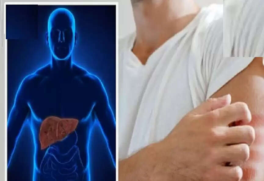 dd