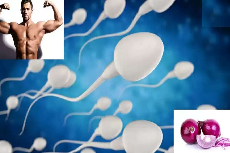DD