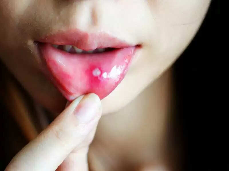 gdf