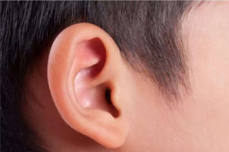IUUI