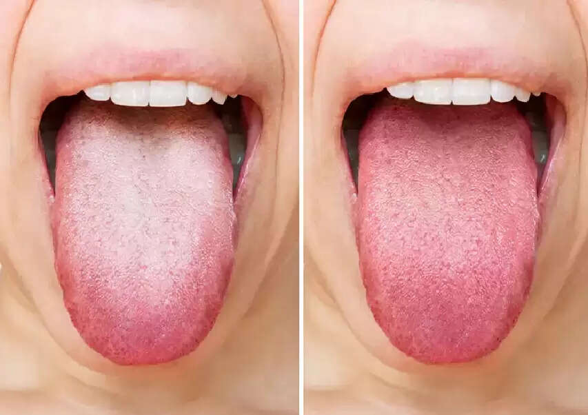 hh