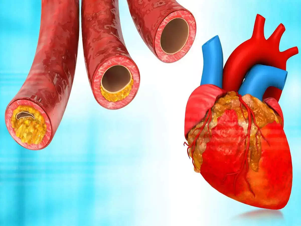 Health Tips- जानिए कोलेस्ट्रोल कम करने के लिए दी जाने वाली गोली, आपका दिल कैसे स्वस्थ रखती हैं
