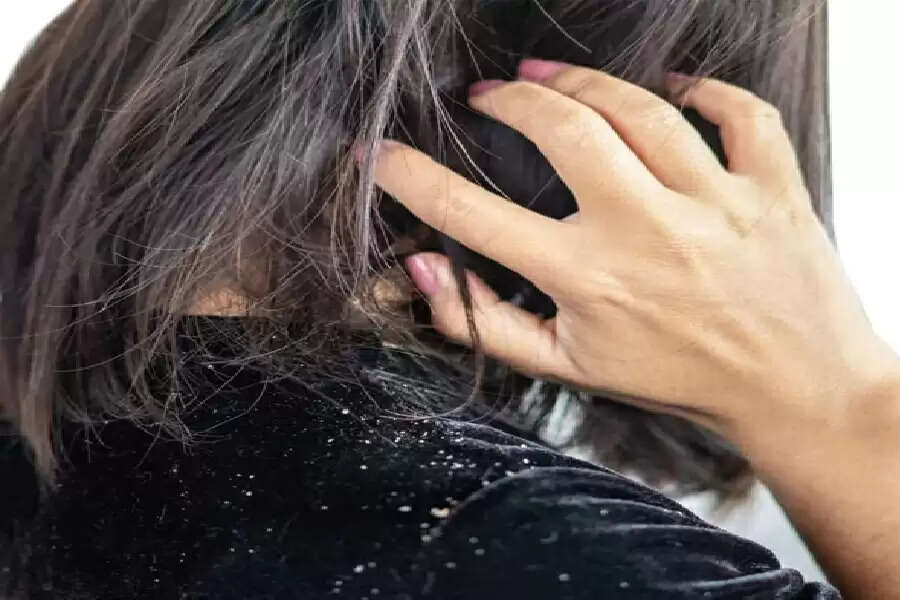 EE
