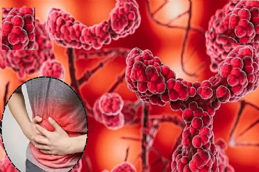 de