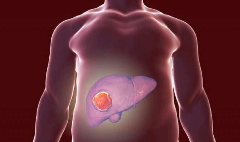 World Hepatitis Day 2021: बासी खाना खाने से हो सकता है लीवर खराब!