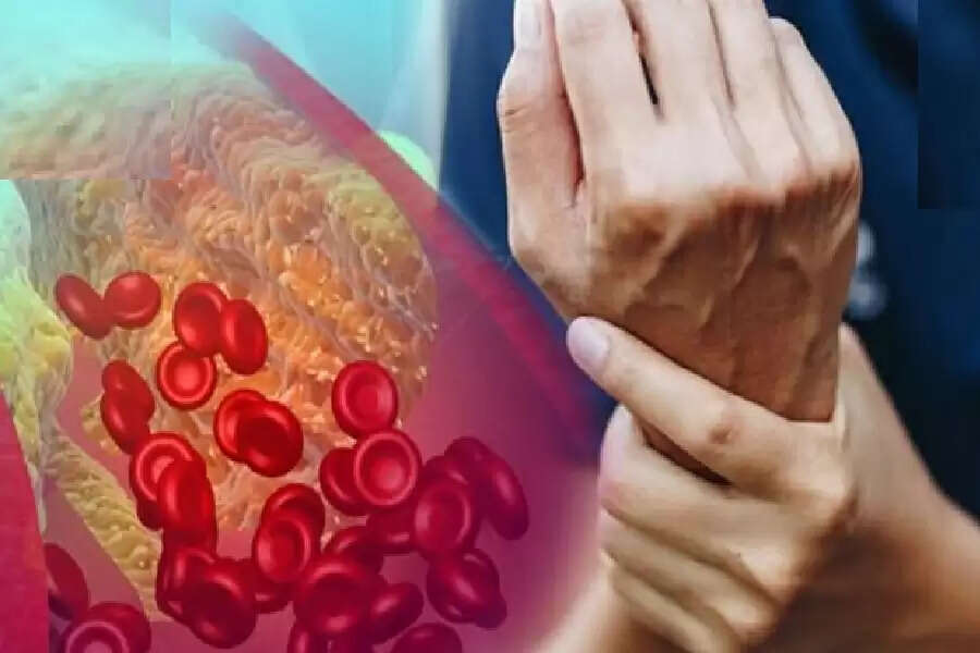 ss